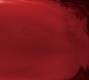 KANDARIVAS/BLOOD SURGICAL DEATH